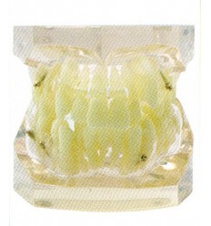 Ortho-model med metal brackets