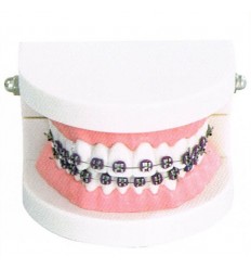 Orthomodel med metal-brackets