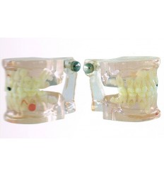 Model blandet alder med caries