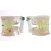 Model blandet alder med caries