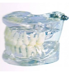 Transparent model med mælketænder