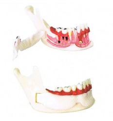 Kæbe-model med åbning til nerver m.m.